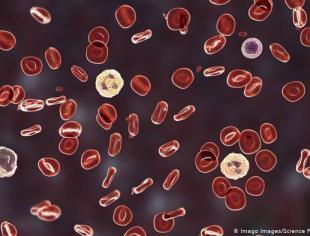DW 3-12-2020 Exame de sangue pode anunciar quadros graves de covid-19