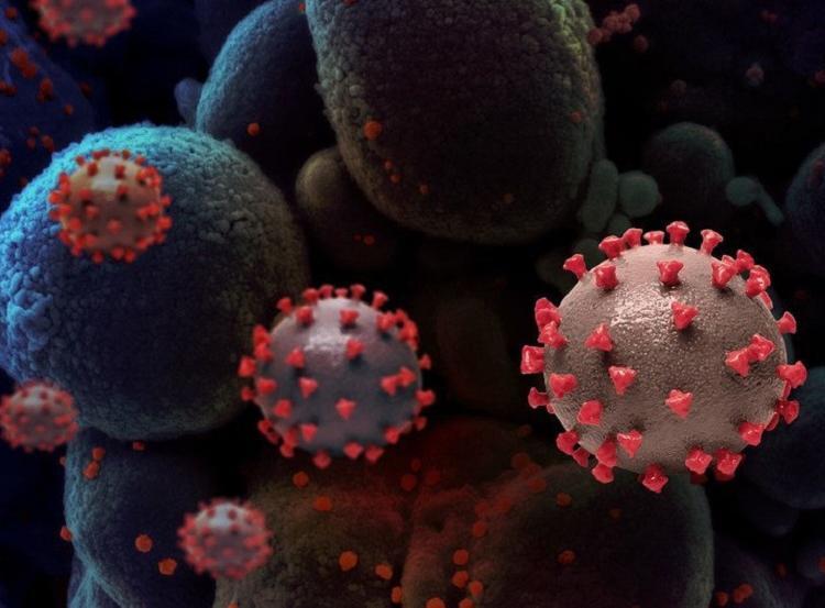 Foto: NIH- ONU News - novo coronavirus